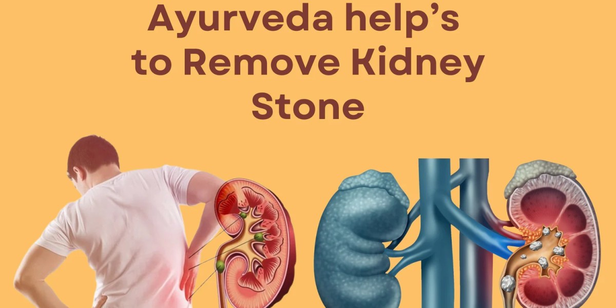 Kidney Stone Ayurvedic Solutions: SL-90 Renal Drop & Stone Removal Capsule