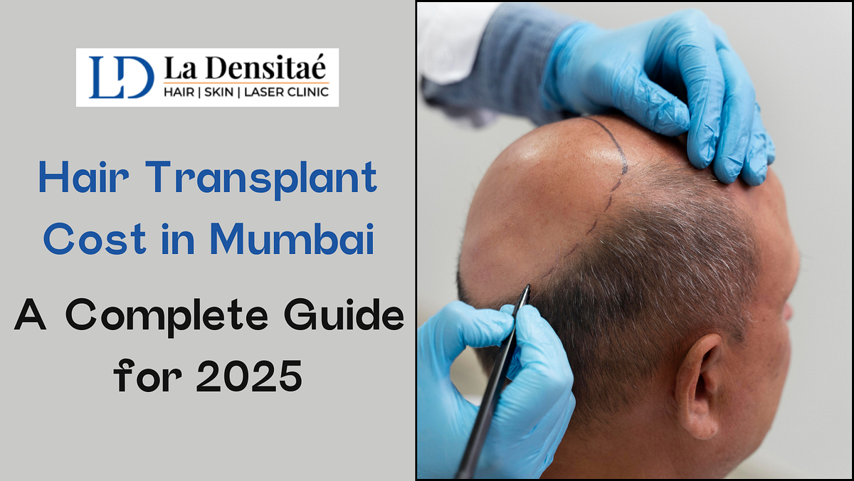 Hair Transplant Cost in Mumbai: A Complete Guide for 2025 | by Ladensitae | Feb, 2025 | Medium