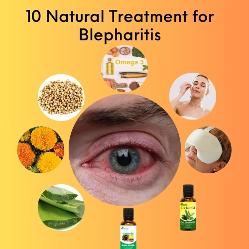 10 Natural Treatment for Blepharitis - Herbal Care Products - Blog