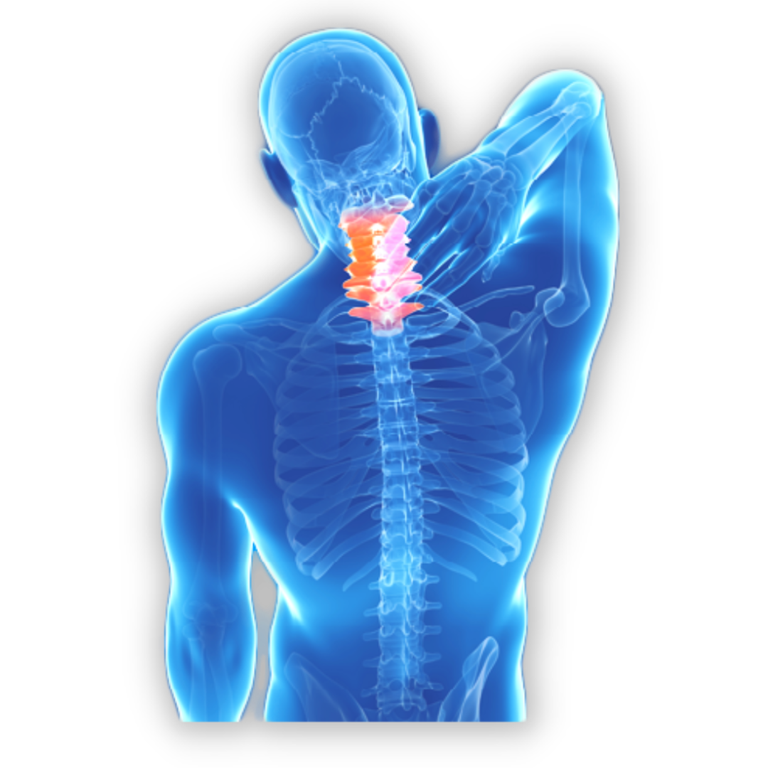 Physical Therapy for Neck Pain Relief - Marcel Jacobs PT