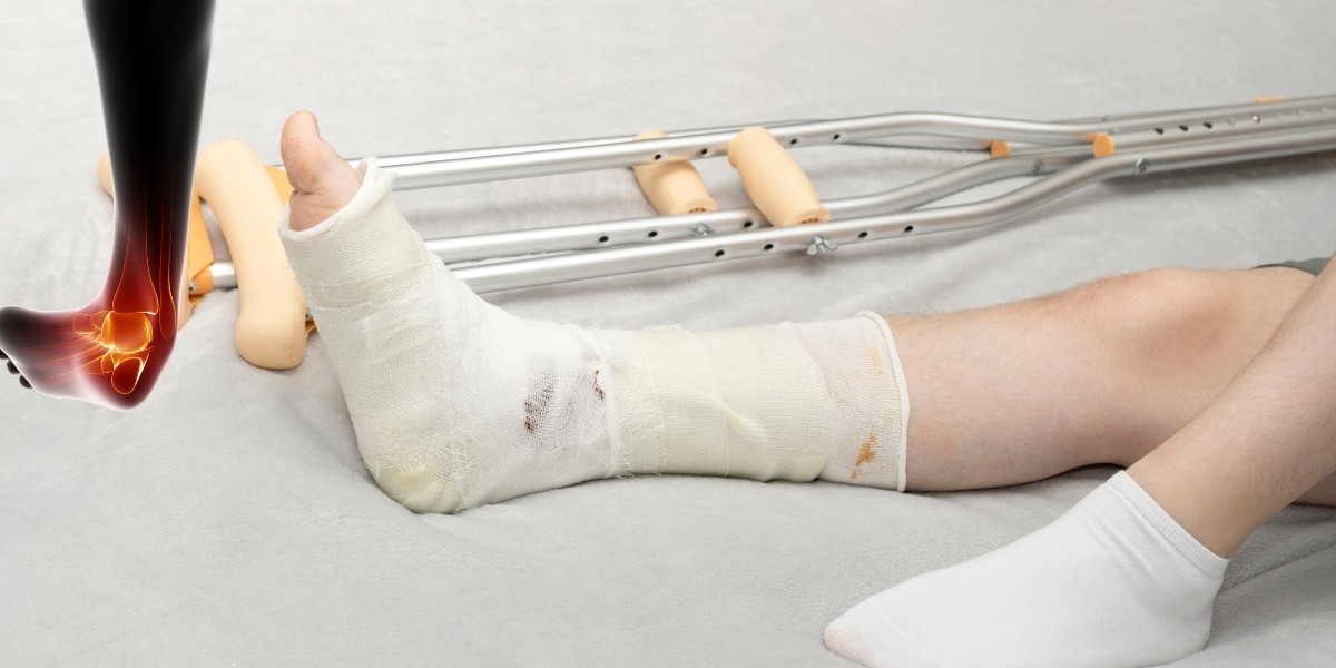 Best Ankle Fracture Treatment in Lahore – Expert Orthopedic Care