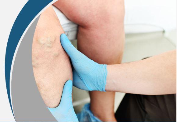 Lymphatic Therapy Courses by Reputed Institutes Opening Great Career Paths | APSense.com