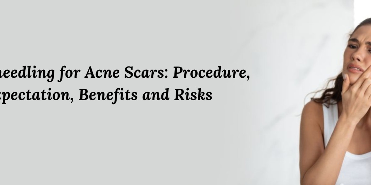 Microneedling for Acne Scars: Procedure, Expectation, Benefits and Risks