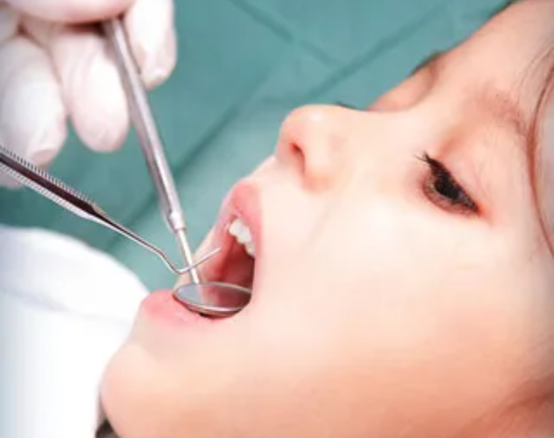 Preventing Crooked Teeth: Tips for Parents to Ensure Their Child’s Healthy Smile – Tiny Teeth