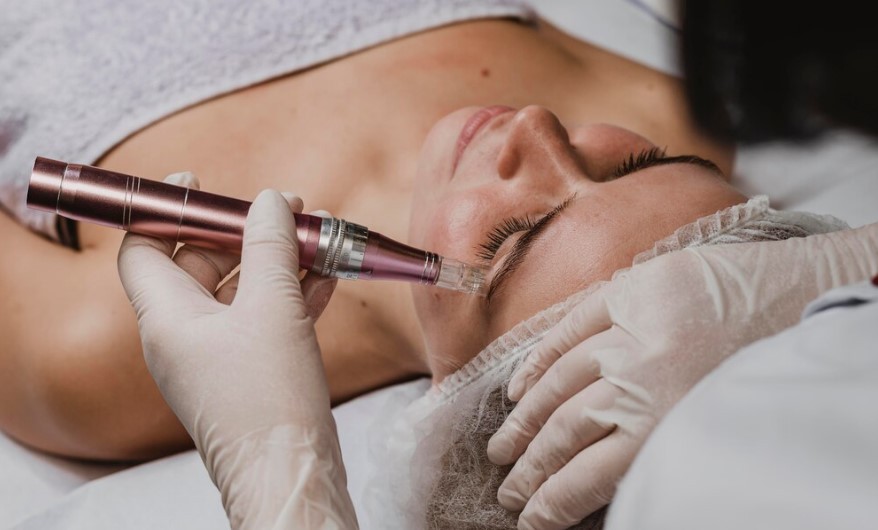 Rejuvenate Your Skin with Expert Microneedling in Houston – @leanish1 on Tumblr