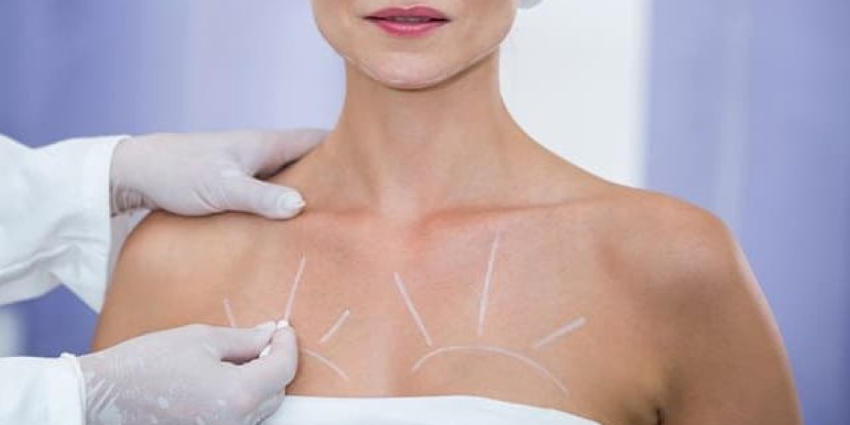 Preparing for Breast Augmentation in Los Angeles: A Step-by-Step Guide